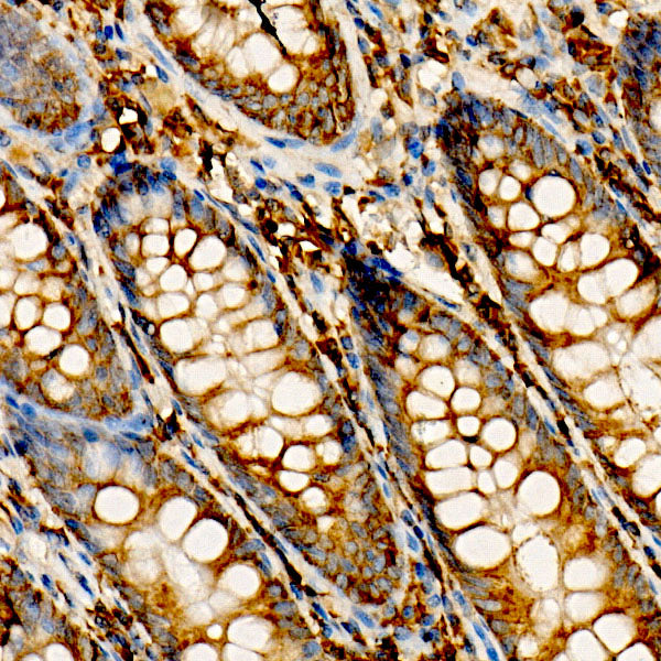 Phospho-Bad-S112 Rabbit mAb