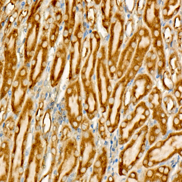 Phospho-Bad-S112 Rabbit mAb