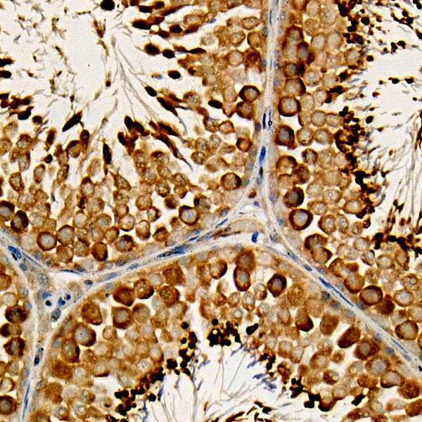 Phospho-Bad-S112 Rabbit mAb