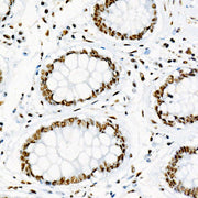 Phospho-p38 MAPK-Y182 Rabbit mAb