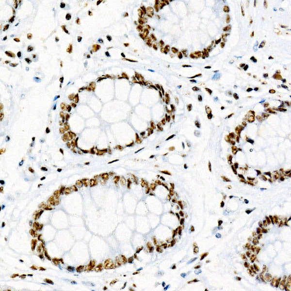 Phospho-p38 MAPK-Y182 Rabbit mAb