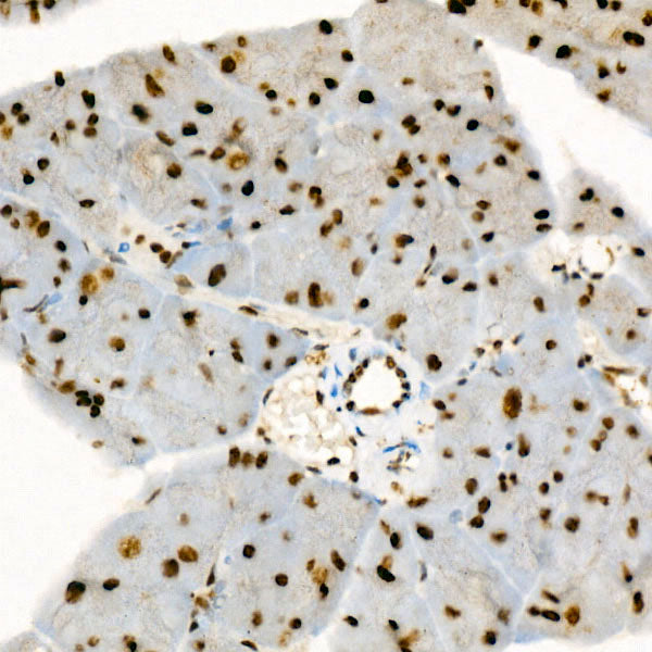 Phospho-p38 MAPK-Y182 Rabbit mAb