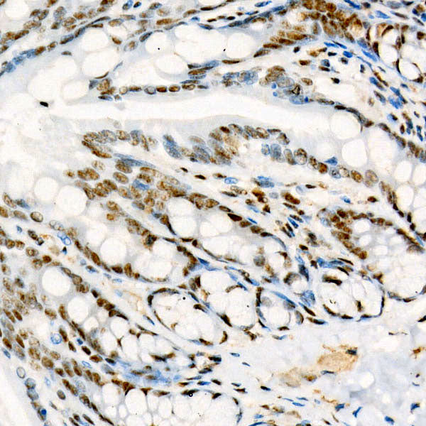 Phospho-p38 MAPK-Y182 Rabbit mAb