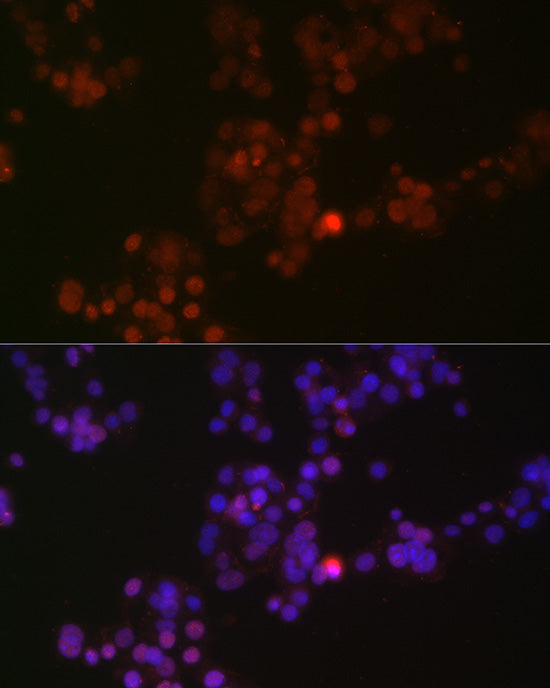 Phospho-p38 MAPK-Y182 Rabbit mAb