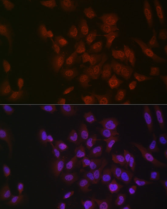 Phospho-p38 MAPK-Y182 Rabbit mAb