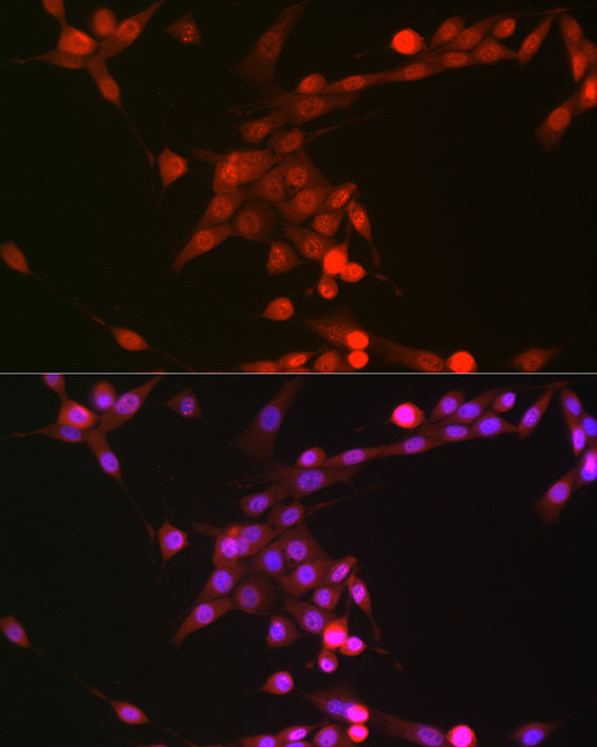 Phospho-p38 MAPK-Y182 Rabbit mAb