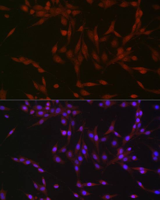 Phospho-p38 MAPK-Y182 Rabbit mAb