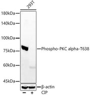 Phospho-PKC alpha-T638 Rabbit mAb