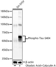Phospho-Tau-S404 Rabbit mAb