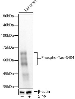 Phospho-Tau-S404 Rabbit mAb