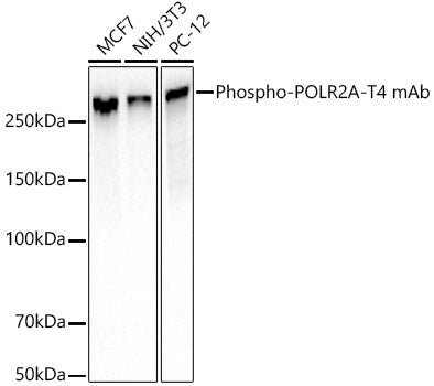 Phospho-Rpb1 CTD-T4 Rabbit mAb
