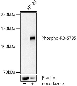 Phospho-RB-S795 Rabbit mAb