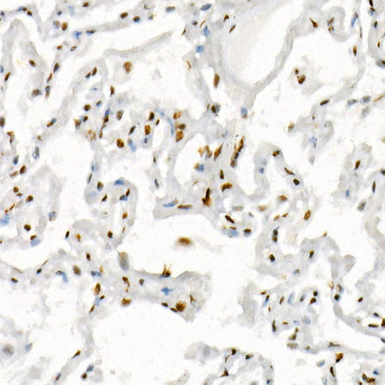 Phospho-RB-S795 Rabbit mAb