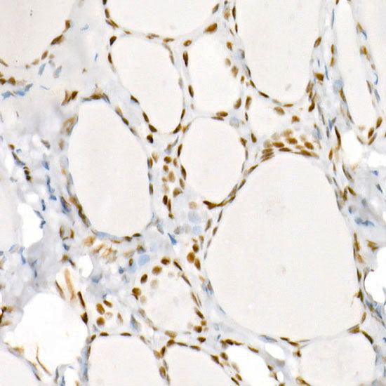 Phospho-RB-S795 Rabbit mAb