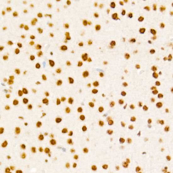 Phospho-RB-S795 Rabbit mAb