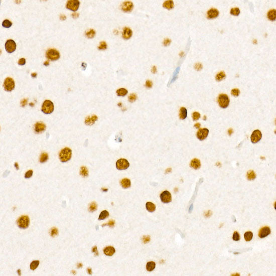 Phospho-RB-S795 Rabbit mAb