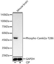 Phospho-Camk2-T286 Rabbit mAb