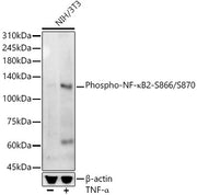 Phospho-NF-κB2-S866/S870 Rabbit mAb