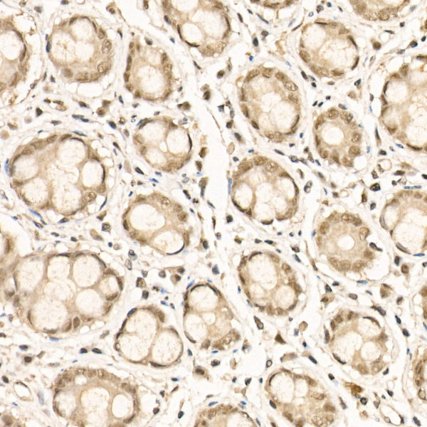 Phospho-NF-κB2-S866/S870 Rabbit mAb