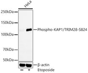 Phospho-KAP1/TRIM28-S824 Rabbit mAb
