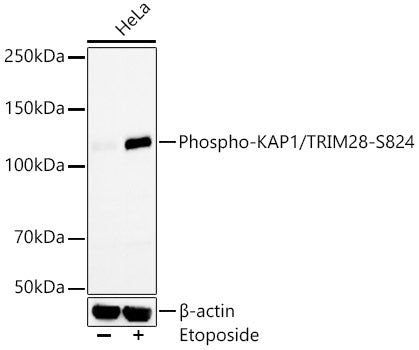 Phospho-KAP1/TRIM28-S824 Rabbit mAb