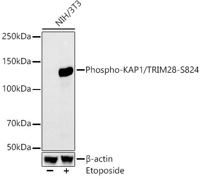 Phospho-KAP1/TRIM28-S824 Rabbit mAb
