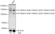 Phospho-HDAC4-S246 + HDAC5-S259 + HDAC9-S220 Rabbit mAb