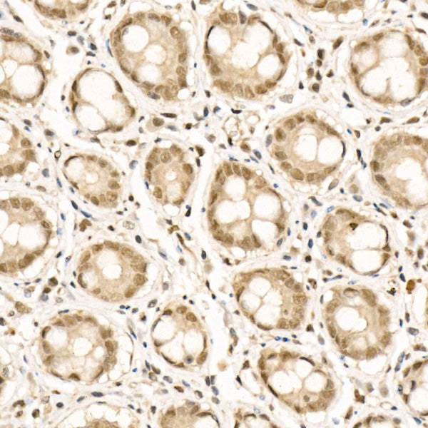 Phospho-HDAC4-S246 + HDAC5-S259 + HDAC9-S220 Rabbit mAb