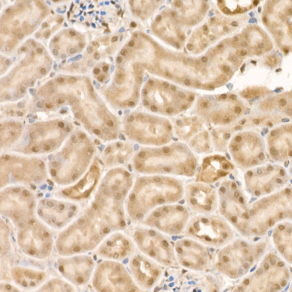 Phospho-HDAC4-S246 + HDAC5-S259 + HDAC9-S220 Rabbit mAb