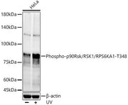 Phospho-p90Rsk/RSK1/RPS6KA1-T348 Rabbit pAb