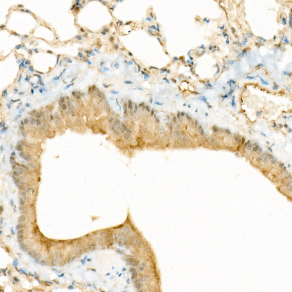 phospho-YAP1-S127 Rabbit mAb