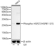 Phospho-HSP27/HSPB1-S15 Rabbit mAb