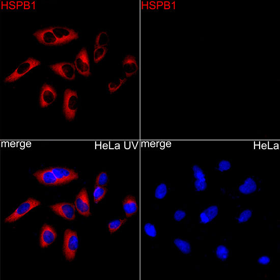 Phospho-HSP27/HSPB1-S15 Rabbit mAb