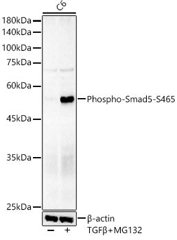 Phospho-Smad5-S465 Rabbit mAb