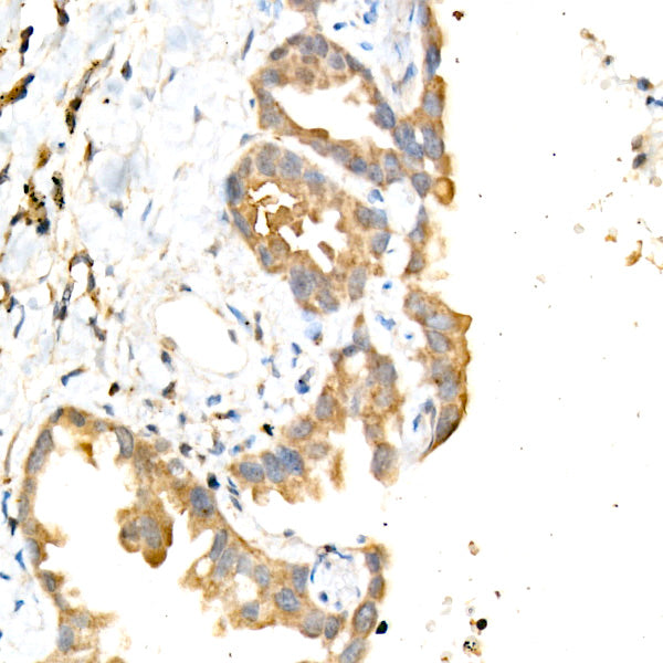Phospho-mTOR-S2448 Rabbit mAb