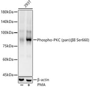 Phospho-PKC (pan) (βII Ser660) Rabbit mAb