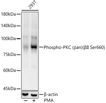 Phospho-PKC (pan) (βII Ser660) Rabbit mAb