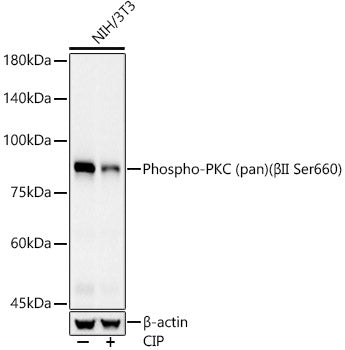 Phospho-PKC (pan) (βII Ser660) Rabbit mAb