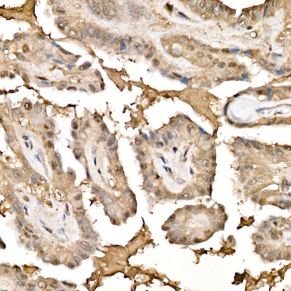 Phospho-PKC (pan) (βII Ser660) Rabbit mAb