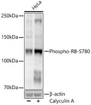 Phospho-RB-S780 Rabbit mAb