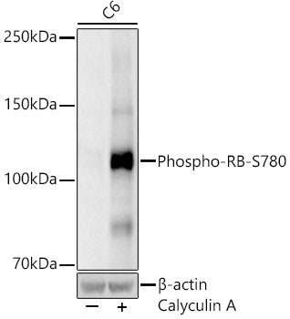 Phospho-RB-S780 Rabbit mAb