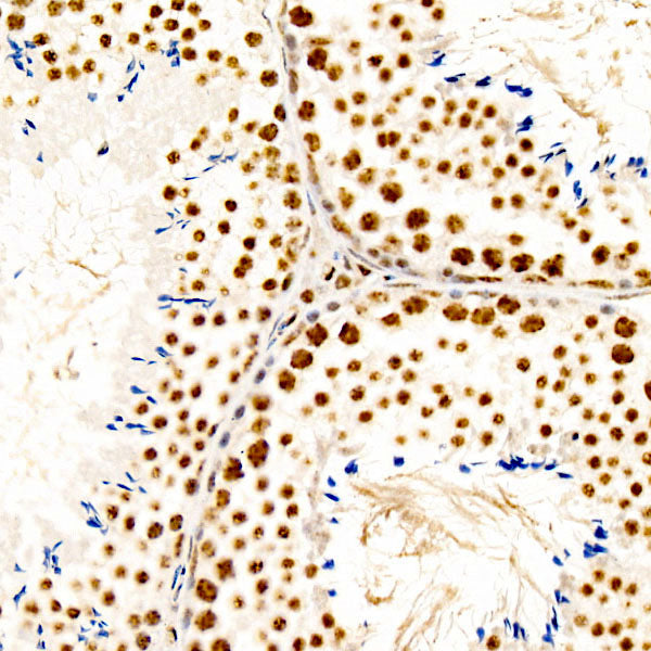 Phospho-CREB1-S133 Rabbit mAb