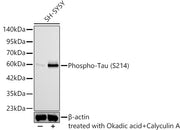 Phospho-Tau (S214) Rabbit mAb