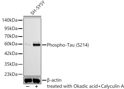 Phospho-Tau (S214) Rabbit mAb