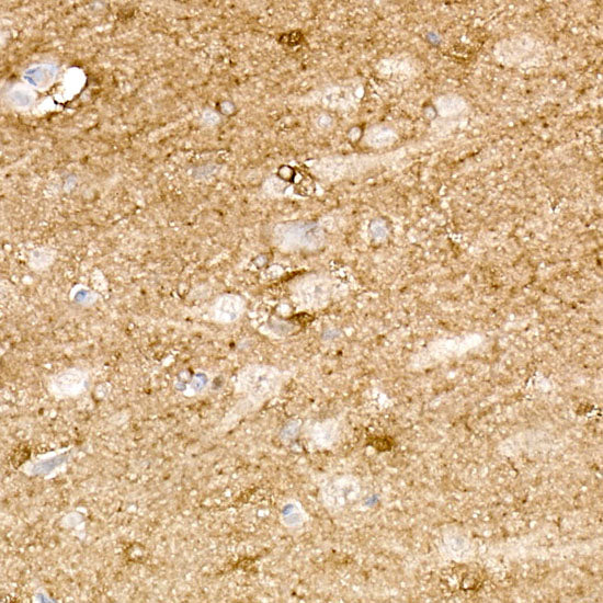 Phospho-Tau (S214) Rabbit mAb