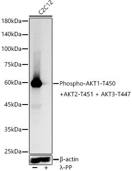 Phospho-AKT1-T450 + AKT2-T451 + AKT3-T447 Rabbit mAb
