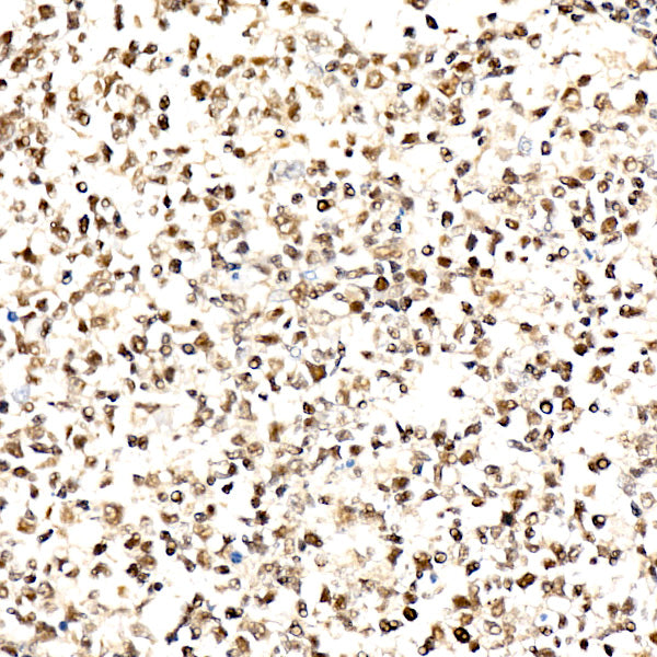 Phospho-AKT1-T450 + AKT2-T451 + AKT3-T447 Rabbit mAb