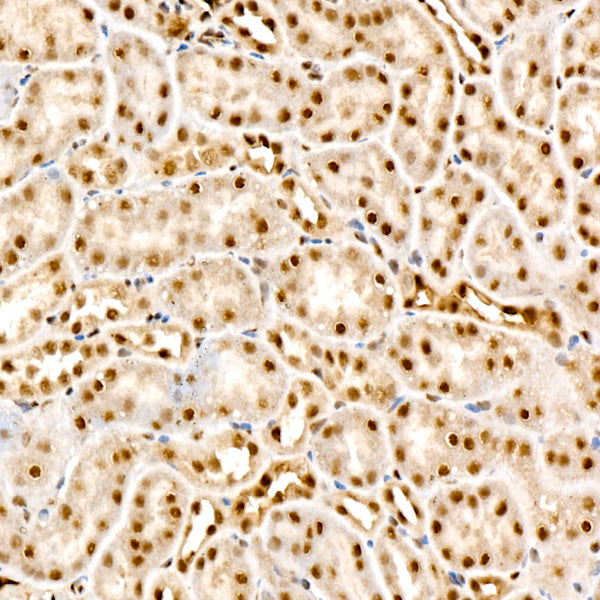 Phospho-AKT1-T450 + AKT2-T451 + AKT3-T447 Rabbit mAb