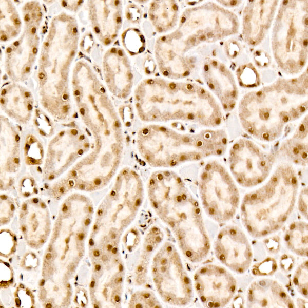 Phospho-AKT1-T450 + AKT2-T451 + AKT3-T447 Rabbit mAb
