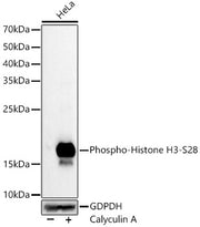 Phospho-Histone H3-S28 Rabbit mAb